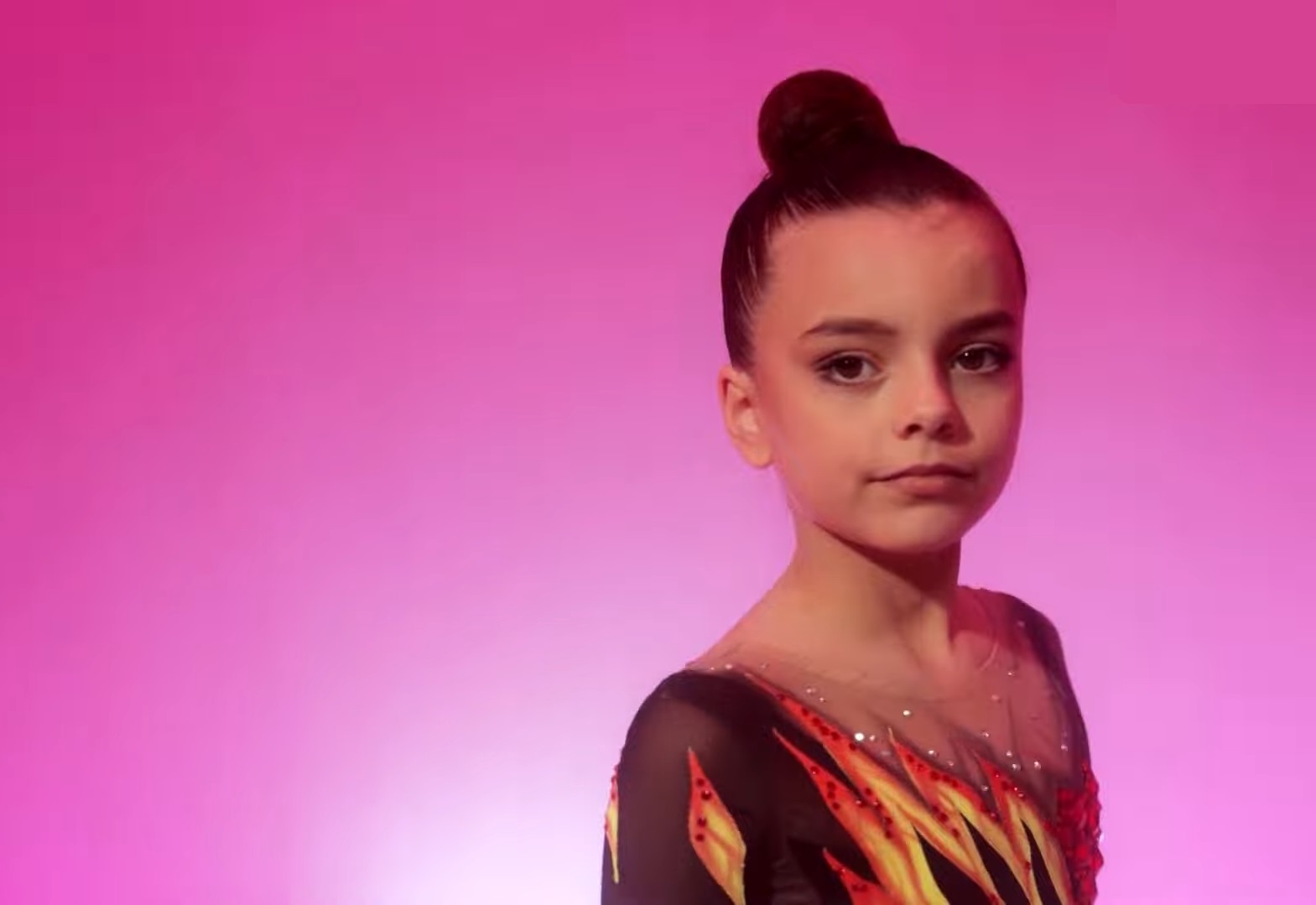 Враг искалечил, но не сломал. Как сегодня живет 7-летняя гимнастка с протезом Саша Паскаль: сильные фото